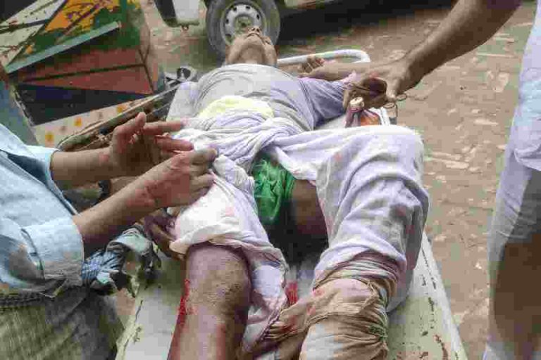 ट्रक की ठोकर से साईकिल सवार वयक्ति बुरी तरह हुए घायल